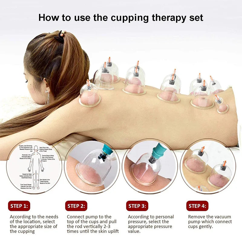 Cupping Kit