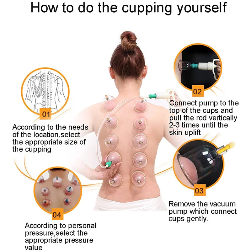 Cupping Kit